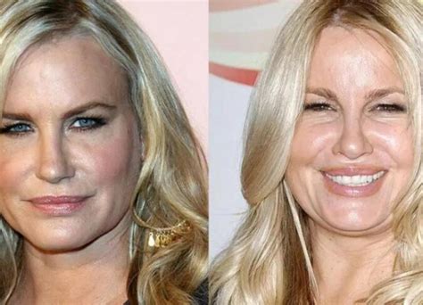 Jennifer Coolidges Plastic Surgery Left Her Smile Looking